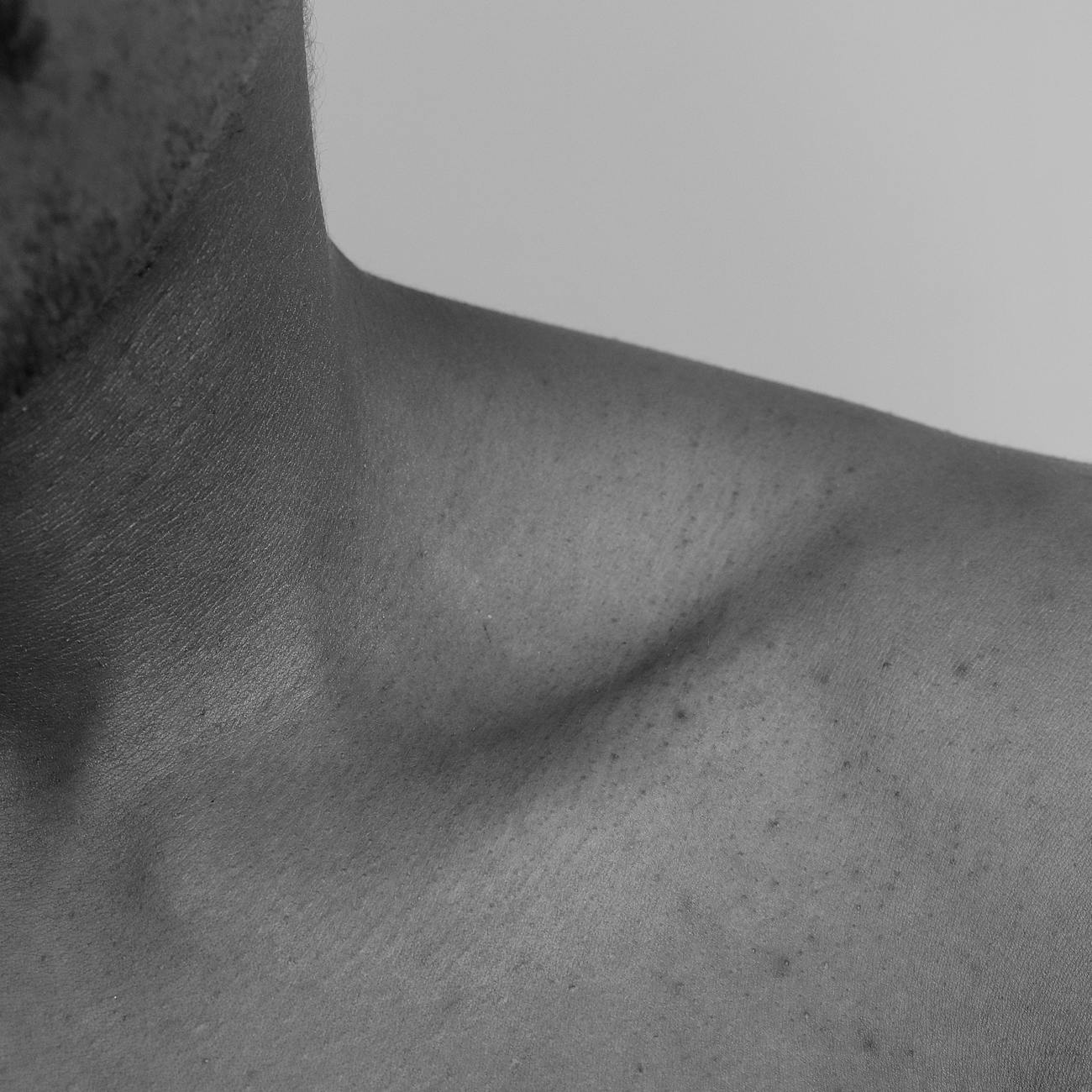 Future Trends in Automated Skin Lesion Analysis.