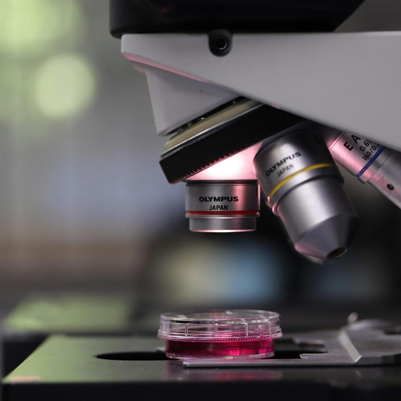 Histopathology and Molecular Biology of Ocular Tumors