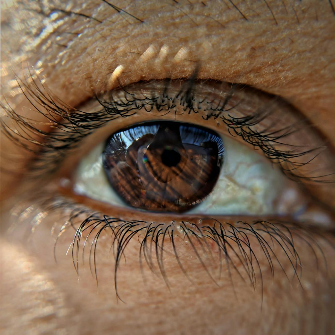 Complications and Prognosis of Ocular Tumors