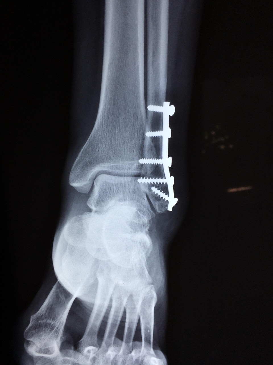 Pain Management in Geriatric Patients
