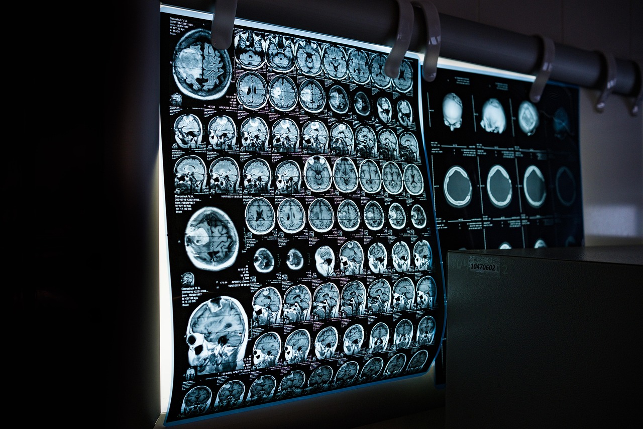 Deep Learning Techniques in Gynecological Imaging