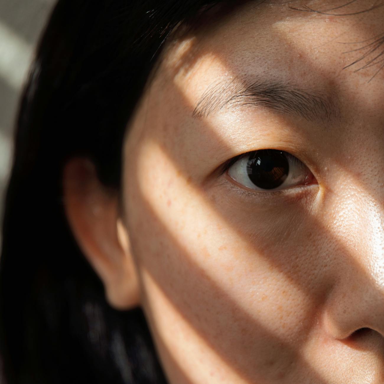 Dermatologic Surgery in Special Populations