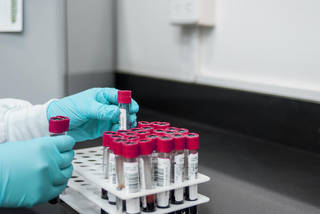 Qualitative Content Analysis: Methods and Approaches