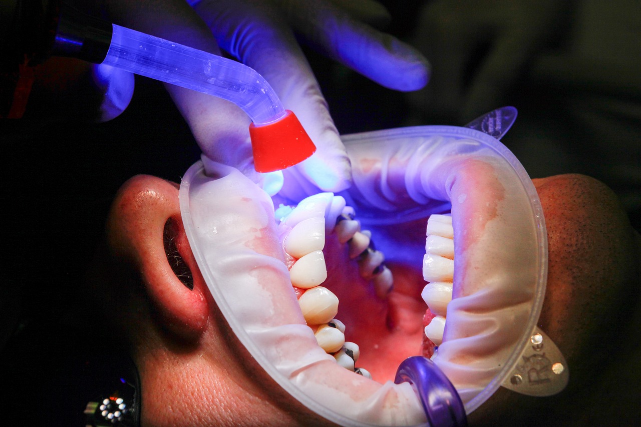 UV Safety Regulations and Standards